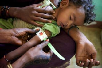 A medical practitioner uses a mid upper arm circumference measuring tape on a child indicating Severe Acute Malnutrition. UNICEF photo